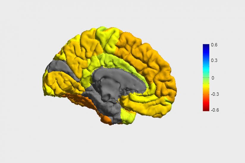 Bipolar Disorder Causes Revealed According to Research